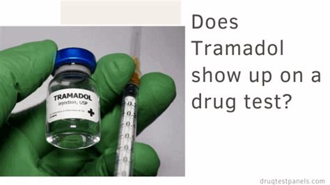 What Does Tramadol Show Up As on a Drug Test: Exploring the Intricacies of Detection and Its Unrelated Philosophical Implications